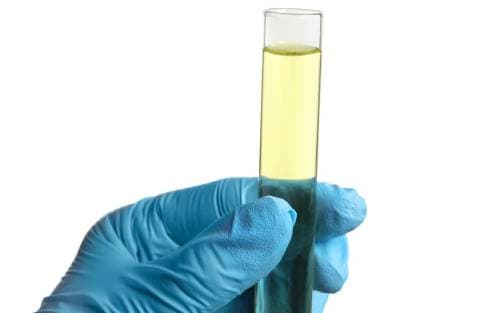 Que se passe-t-il avec les excréments et l’urine dans la fosse septique ?